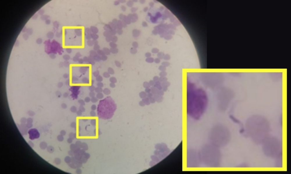 Fapesp: Técnica baseada em inteligência artificial permite detectar doença de Chagas com imagem de celular