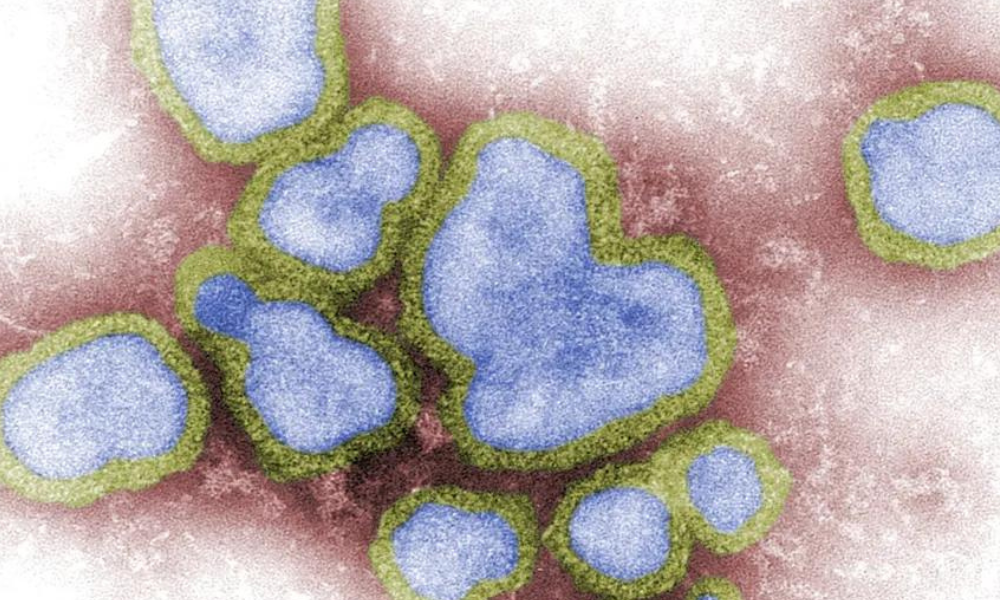 G1: Aumento de casos de influenza A em SP preocupa especialistas, mas pode ser reflexo de inverno atípico