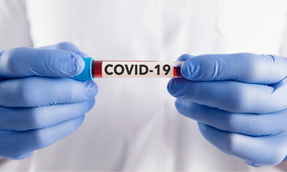 UOL: Covid-19 aumentou no Brasil? Quais os cuidados recomendados neste momento?