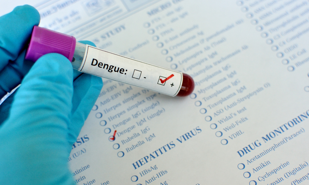 Estadão: Em São Paulo, 72% da população pode estar vulnerável à infecção por vírus da dengue, mostra estudo