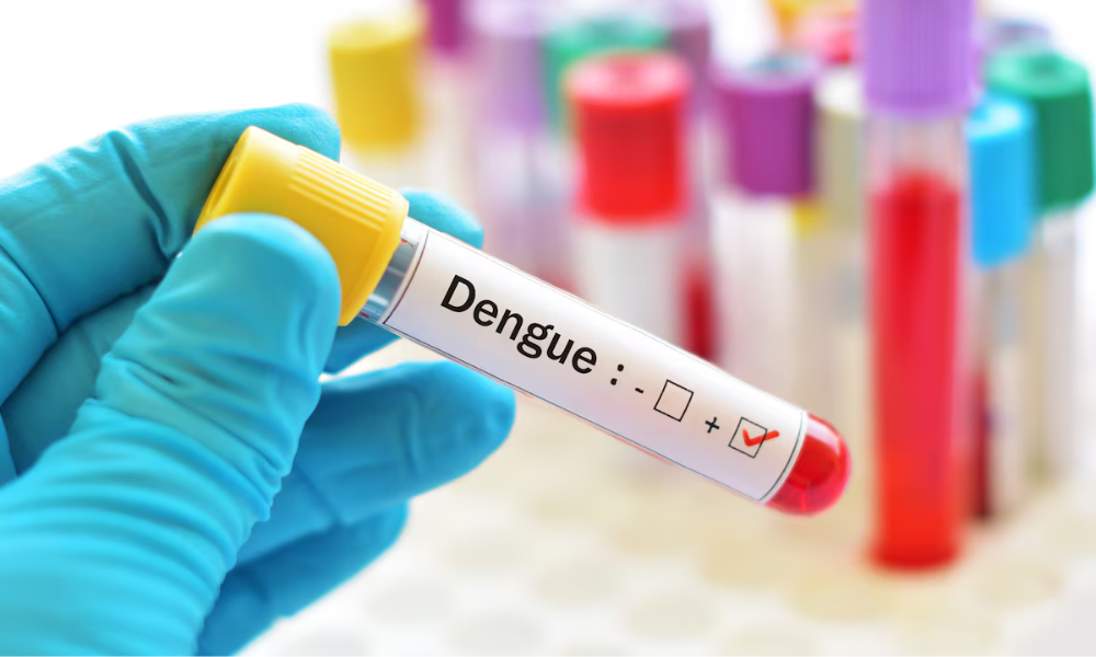 Estadão: Em São Paulo, 72% da população pode estar vulnerável à infecção por vírus da dengue, mostra estudo